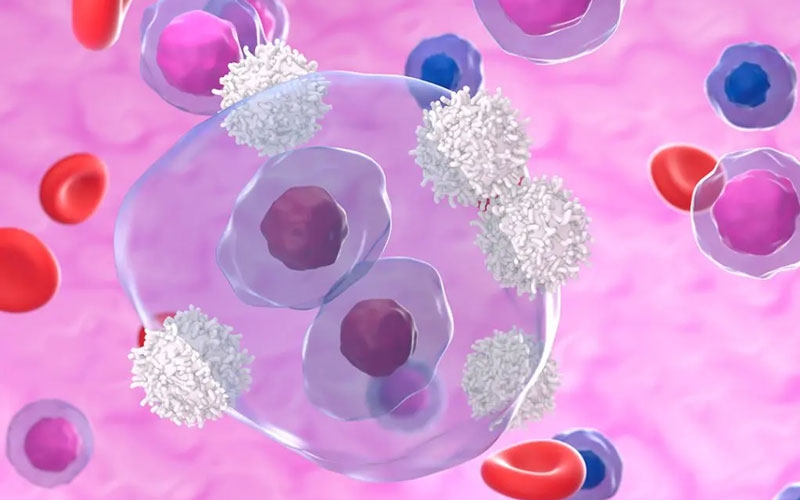 Simposio: Situaciones difíciles en el tratamiento de los linfomas
