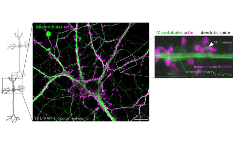 Seminario: El ciclo de tirosinación y detirosinación de la tubulina: avances de los últimos 20 años